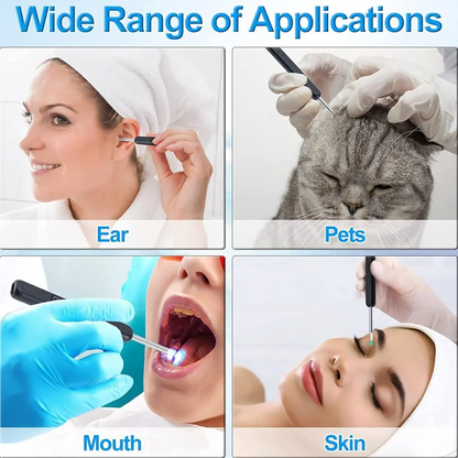 Barqon Waterproof Ear Wax Removal Cleaner Kit